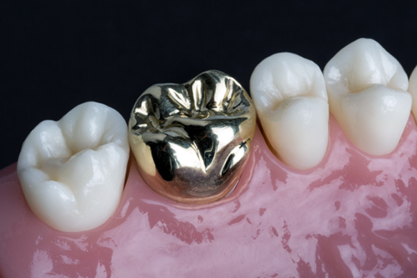 Metal Crown