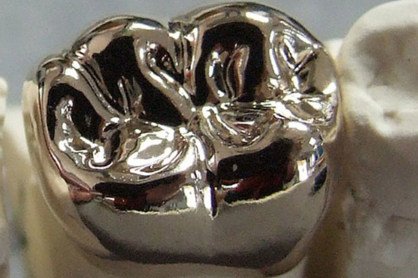 Metal Crown